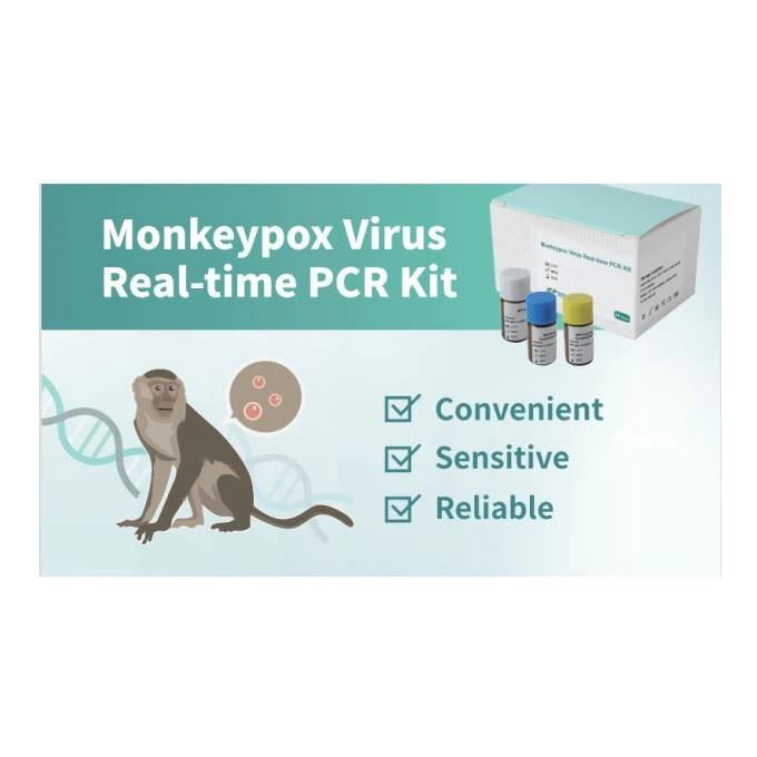 원숭이폭스 바이러스 실시간 PCR